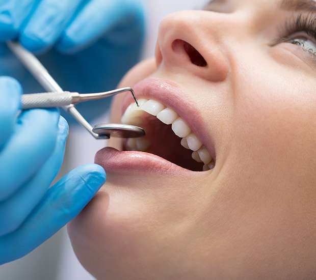 San Ramon Dental Bonding