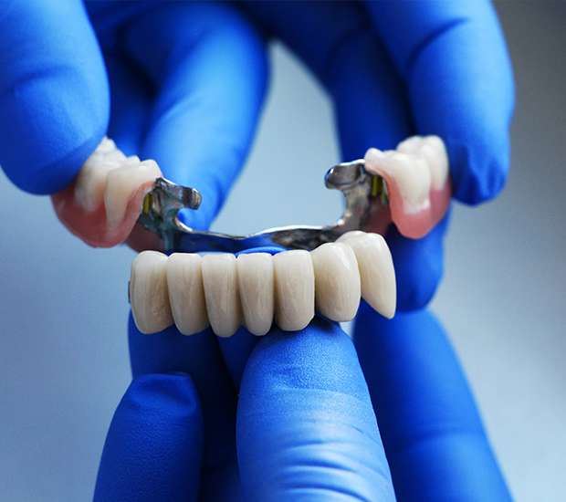 San Ramon Dental Bridges
