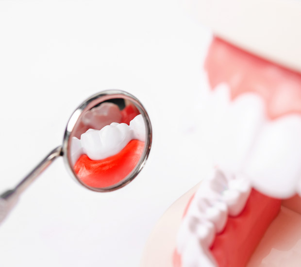 San Ramon Interactive Periodontal Probing
