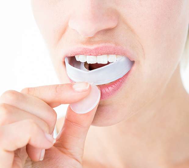 San Ramon Mouth Guards
