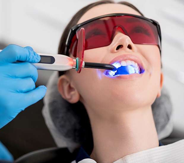 San Ramon Professional Teeth Whitening
